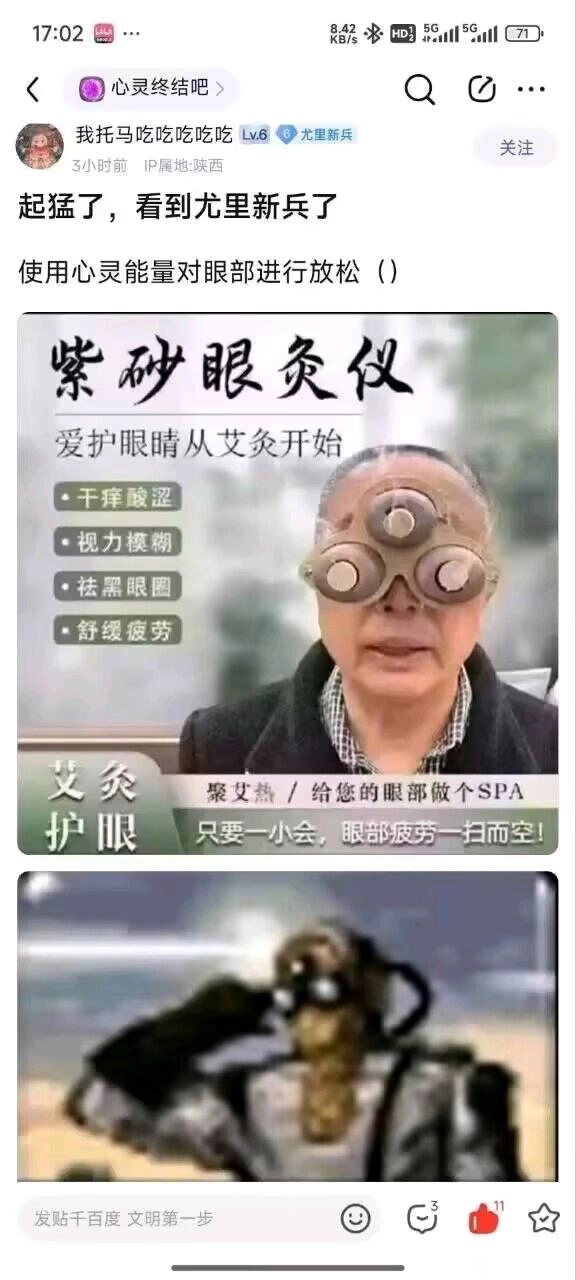 中医乐子多，紫砂眼灸仪 - 吐槽银魂 - 大众生活 - 万事屋